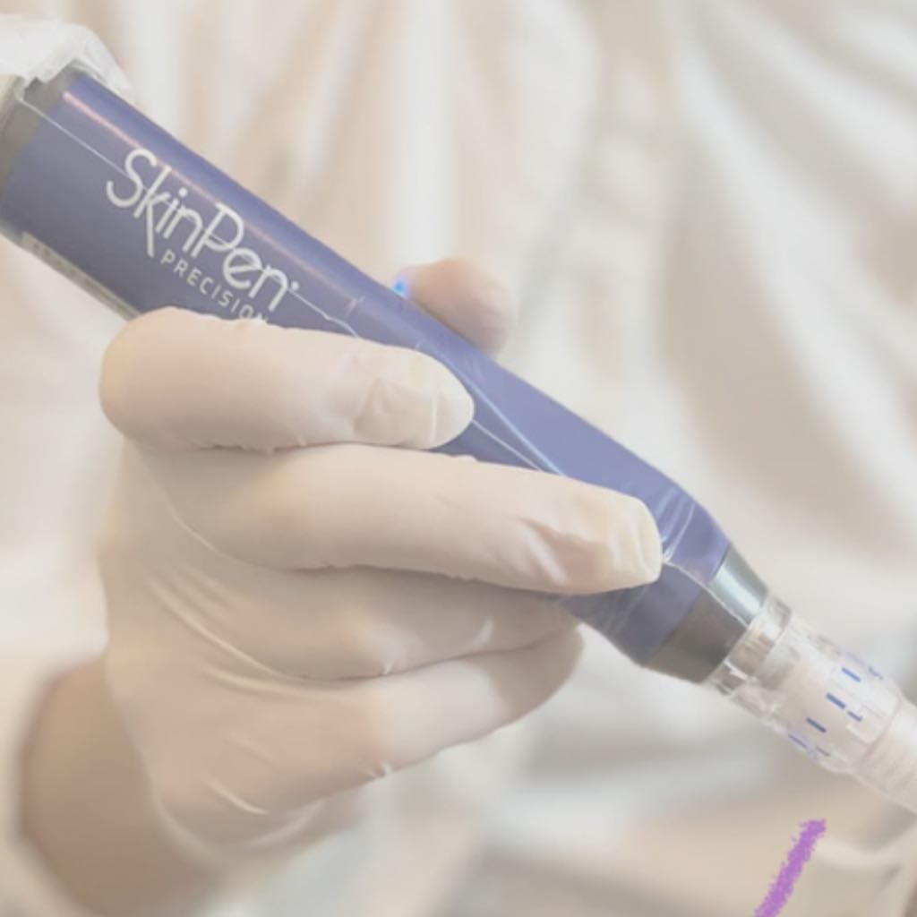 SkinPen microneedling behandling i Silkeborg